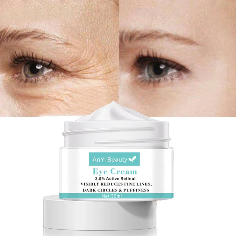 30ml tube of Beauty Eye Cream for women's dark circle treatment