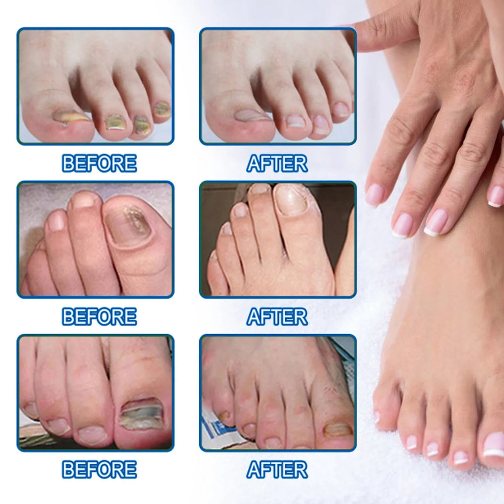 Box of 32 nail care repair adhesive bandages with glycerin and vitamin E