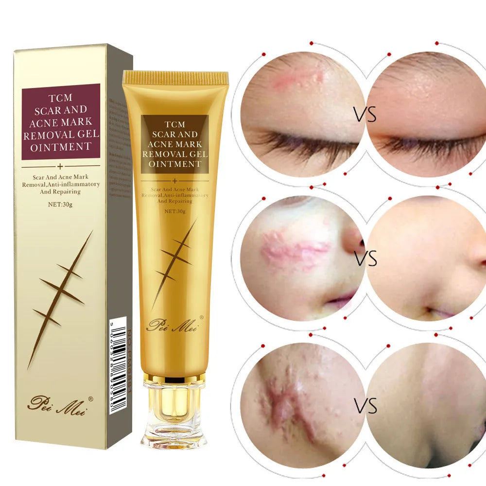 Light Scar Cream PM6881 scar treatment gel for fine grain desalination face and body