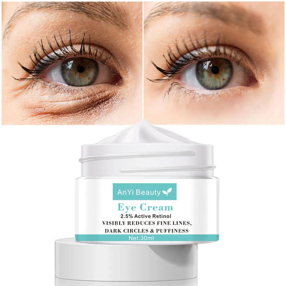 30ml tube of Beauty Eye Cream for women's dark circle treatment