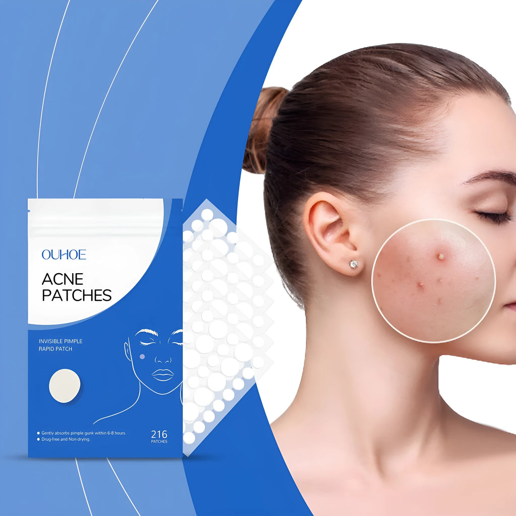 216 hydrocolloid acne patches with tea tree oil and vitamin E for blemish treatment