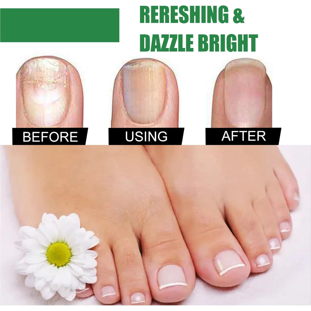 30ml bottle of tea tree oil nail care repair fluid for thick soft nails