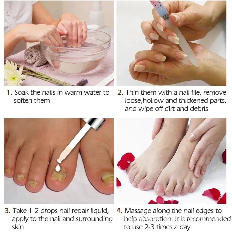 Jia Gou Deck Liquid Antimicrobial Repair Dust 10ml foot treatment bottle
