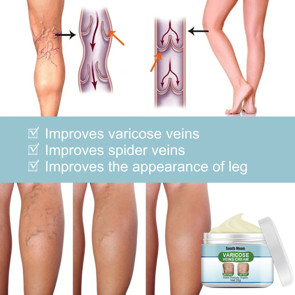 20g tube of unscented vein repair cream for varicose vein relief targeting green tendon bulges