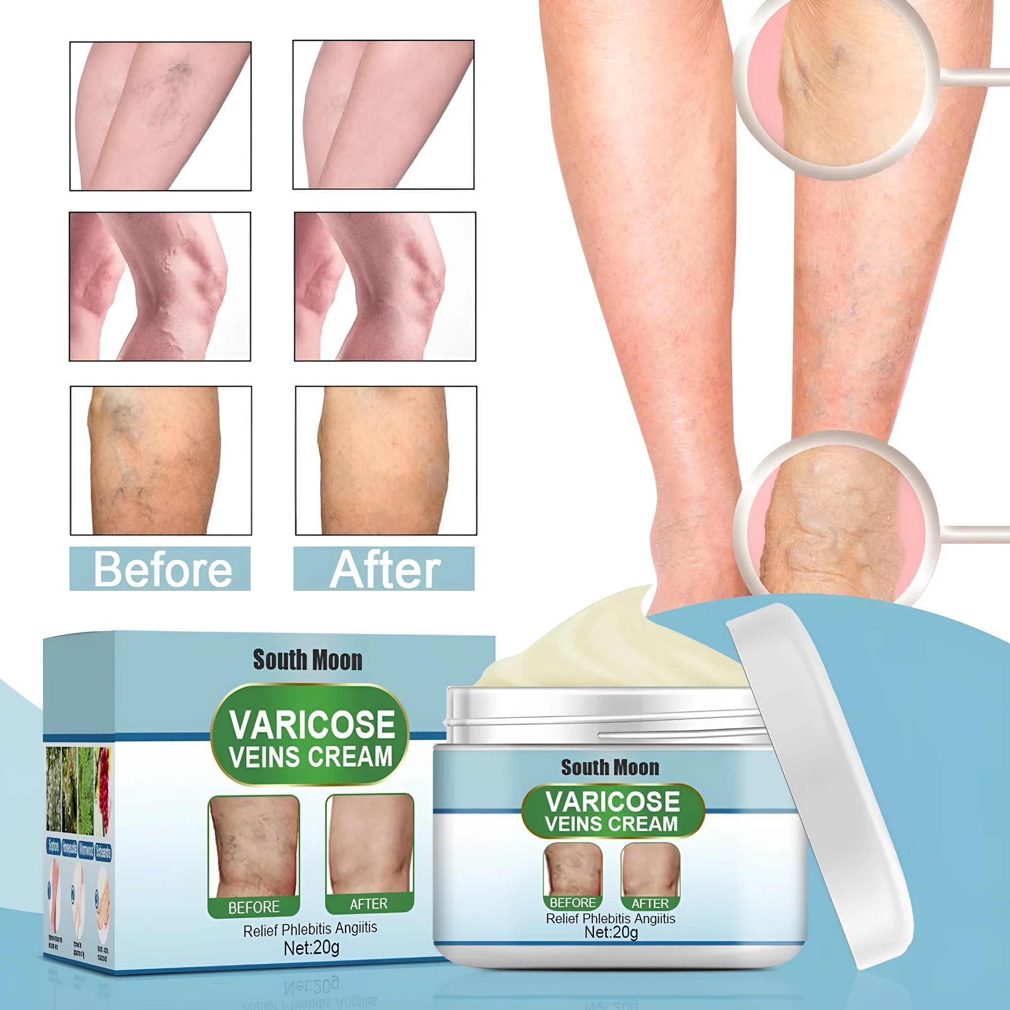 20g tube of unscented vein repair cream for varicose vein relief targeting green tendon bulges