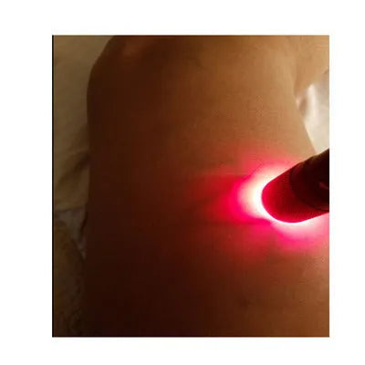 Black aluminium alloy Smart Vein Locator medical device for illuminating veins on skin.