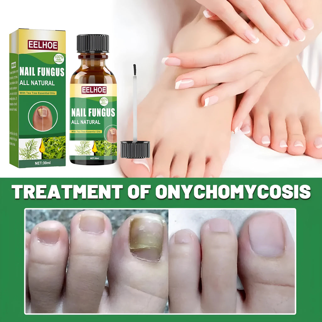 30ml bottle of tea tree oil nail care repair fluid for thick soft nails