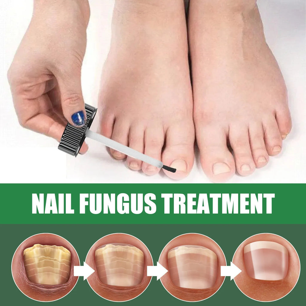 30ml bottle of tea tree oil nail care repair fluid for thick soft nails
