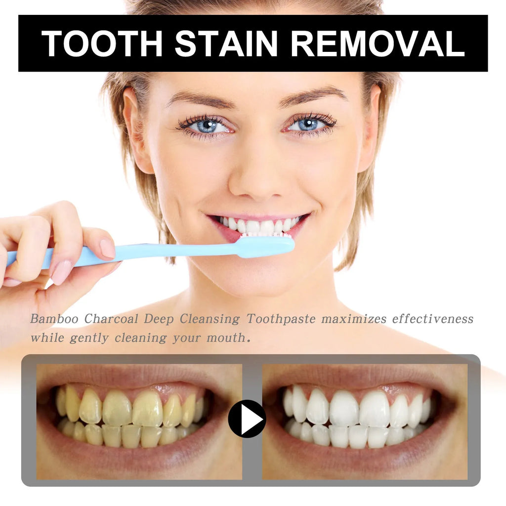 30ml tube of Bamboo Charcoal Bright White Stain Removing Toothpaste, showing dimensions.