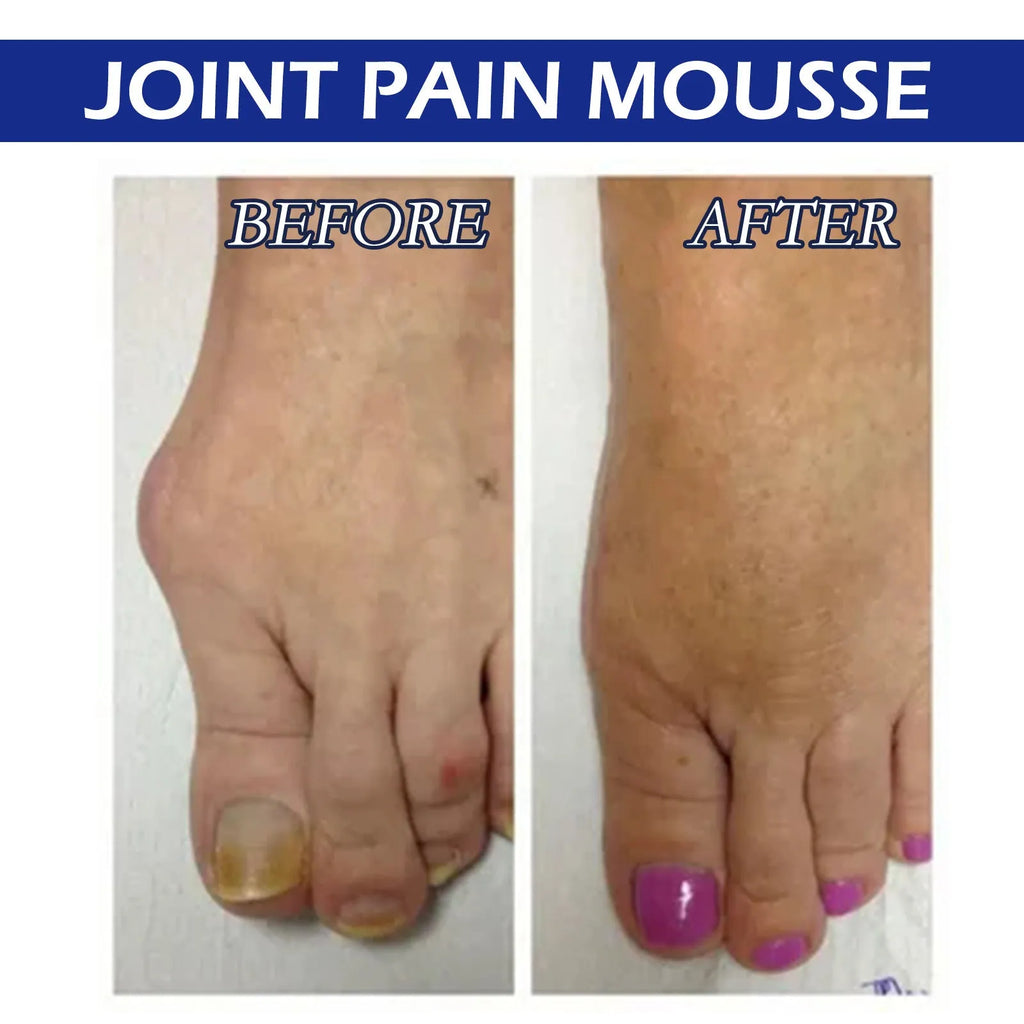 15ml bottle of herbal massage drops for joint and muscle soreness relief