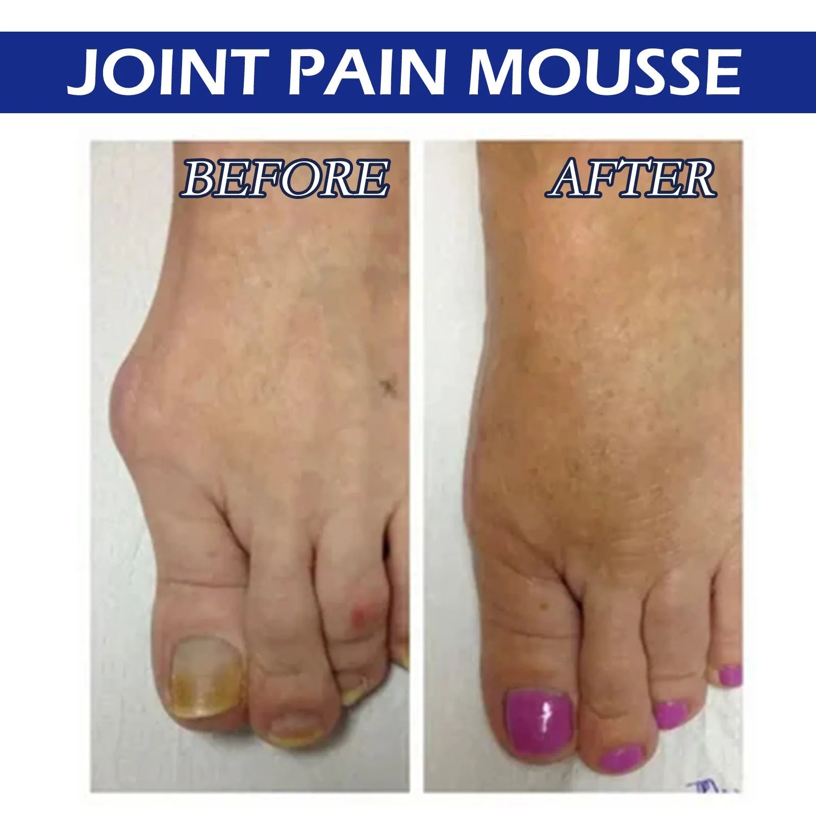 15ml bottle of herbal massage drops for joint and muscle soreness relief