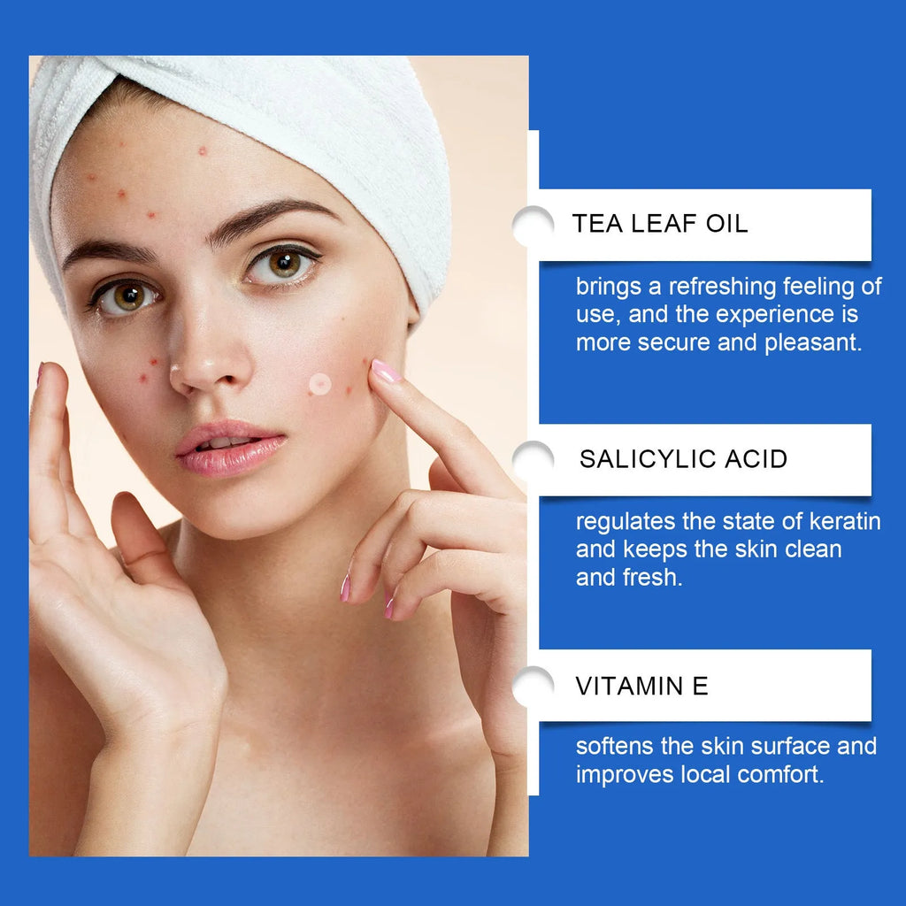216 hydrocolloid acne patches with tea tree oil and vitamin E for blemish treatment
