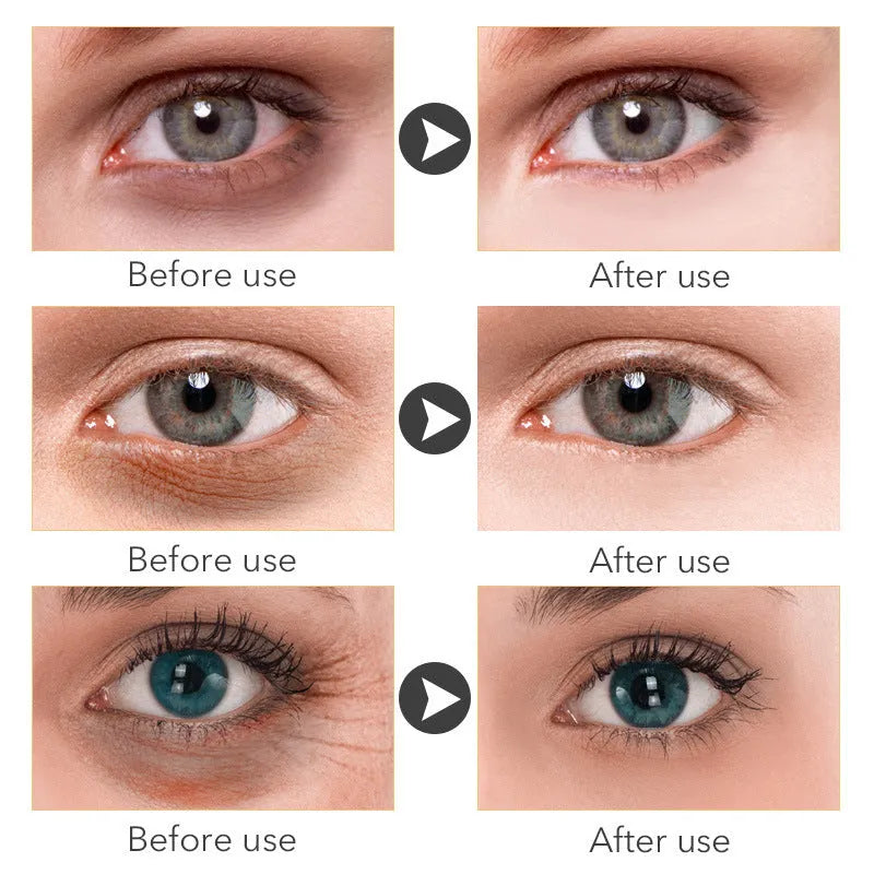 30ml tube of Beauty Eye Cream for women's dark circle treatment