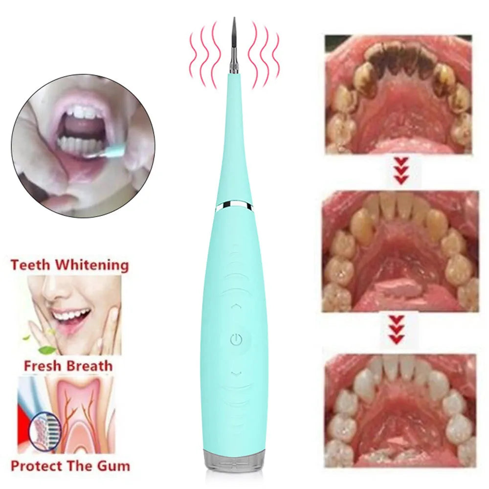 Pink and blue waterproof electric tooth scaler with integrated handle on a bathroom counter.