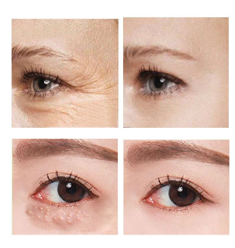 30ml tube of Beauty Eye Cream for women's dark circle treatment